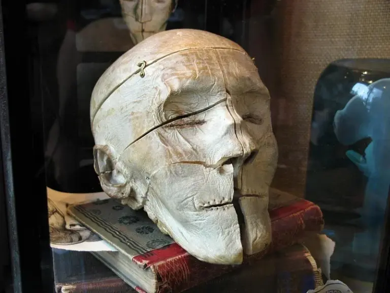 Mütter Museum